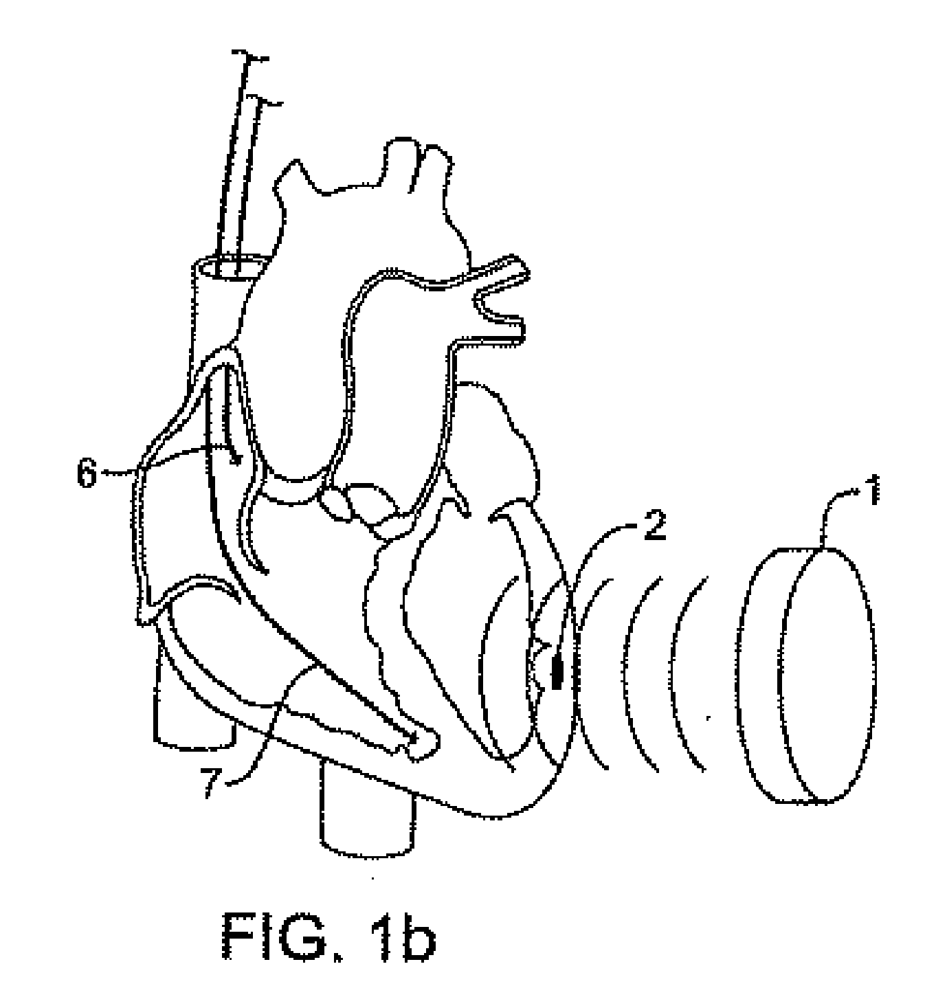 heart figure 2