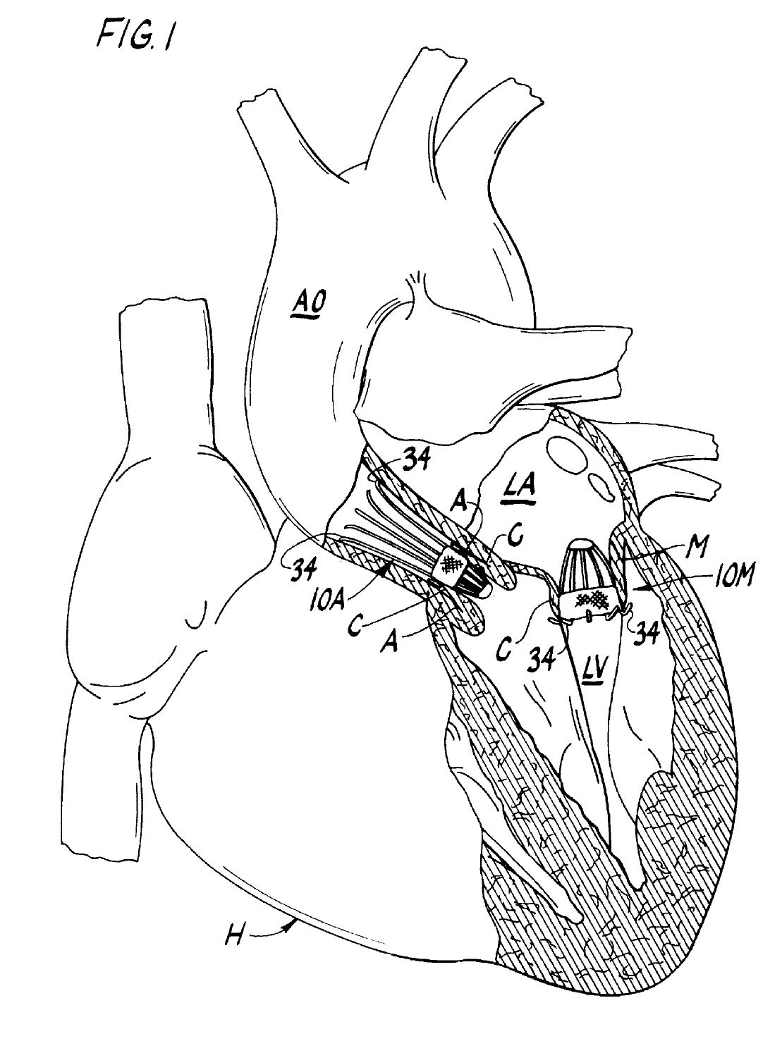 heart figure heart figure